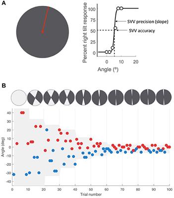 Errors of Upright Perception in Patients With <mark class="highlighted">Vestibular Migraine</mark>